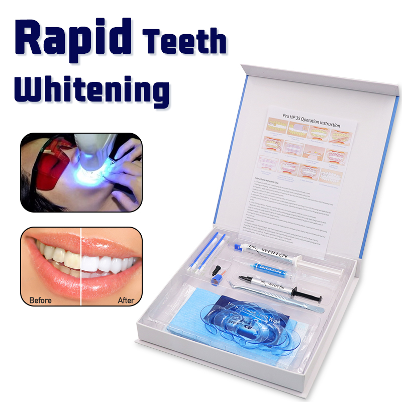 Kit professionale per sbiancam - Teeth Whitening Kit recensione e prezzo