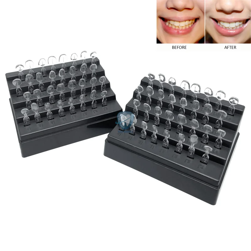 32 pz/set Kit di Stampi per Im - Teeth Whitening Moulds recensione e prezzo